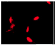 PYK10 | Beta-Galactosidase (internal) (ER marker, immunolocalisation) in the group Antibodies Plant/Algal  / Membrane Transport System / Endomembrane system at Agrisera AB (Antibodies for research) (AS20 4409)